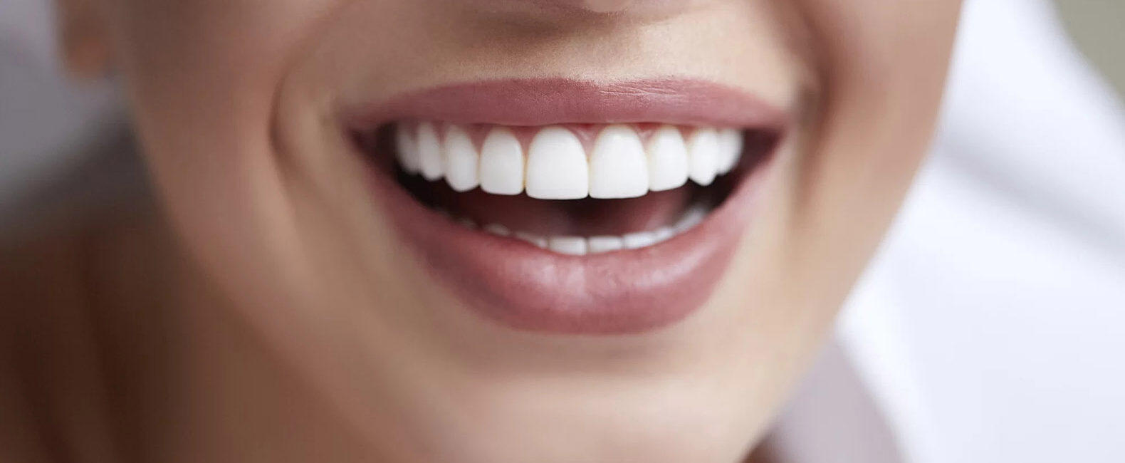 dental veneers are cosmetic dentists