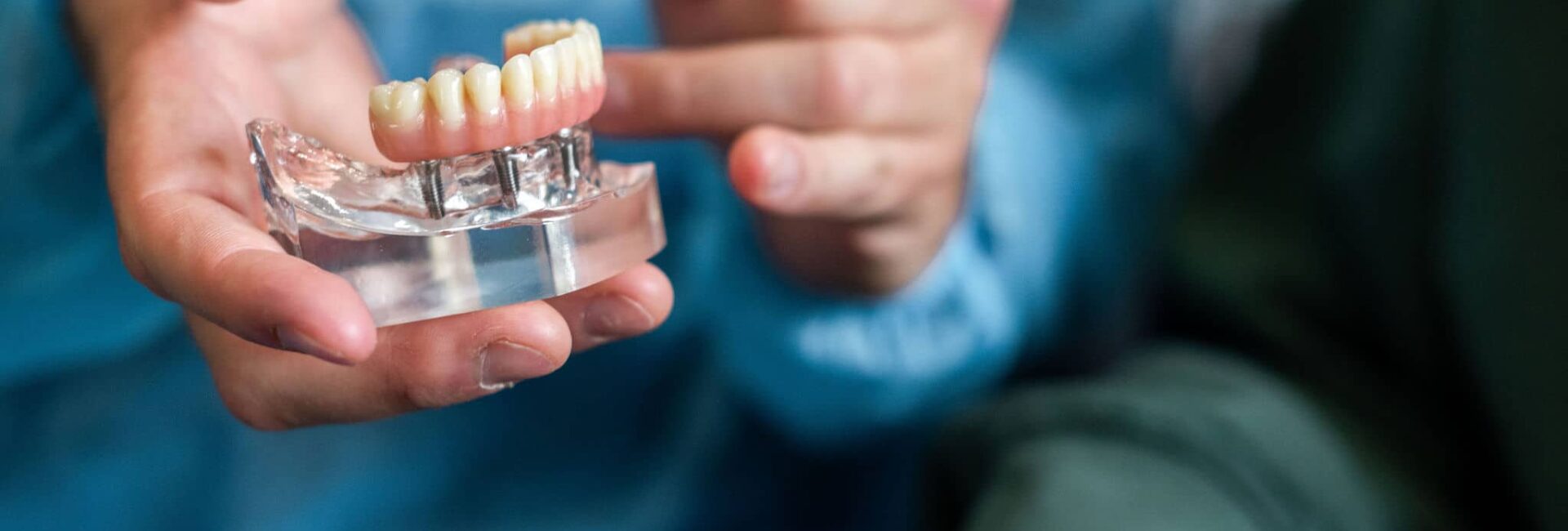 Global Dental Implants Market