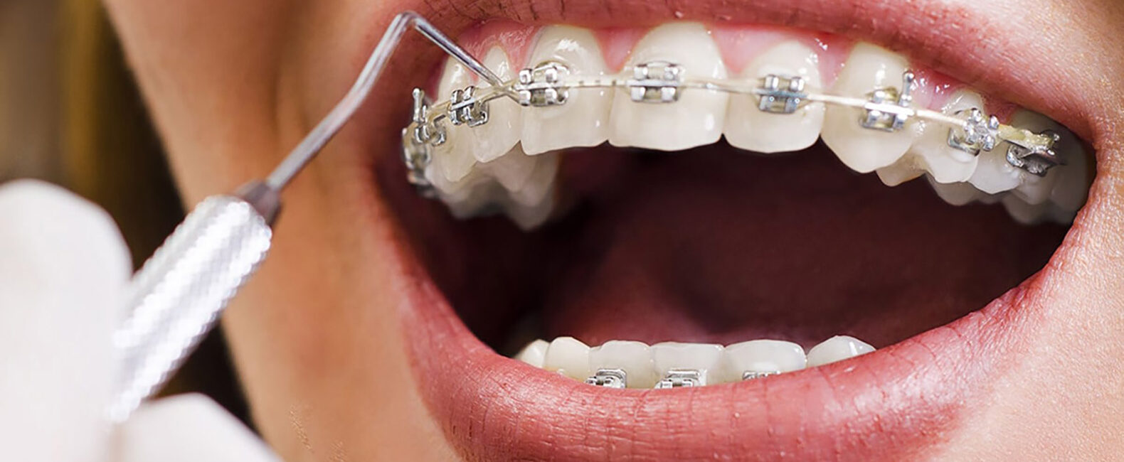 Digital Marketing for Orthodontists