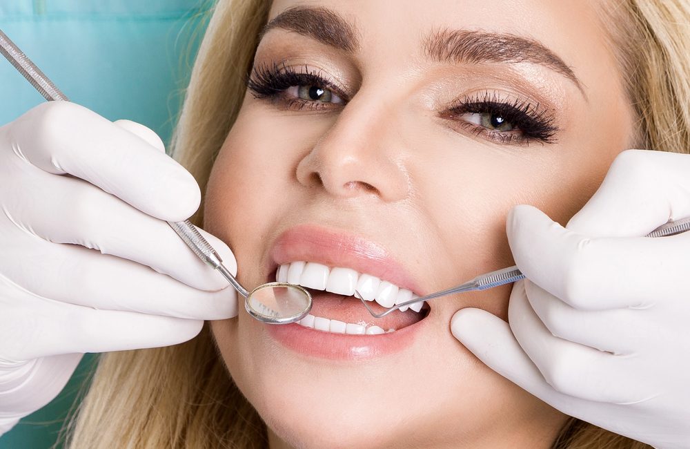 dental veneers