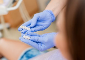 dental bridges