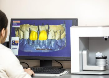 Digital Smile Design