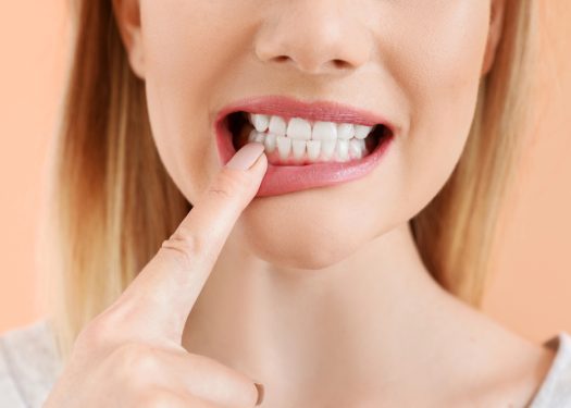 preventing periodontal disease