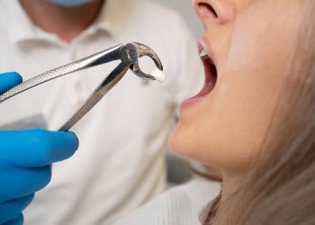 Tooth Extraction: How to Ease the Pain Naturally