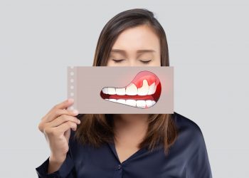 dental implants gingivitis