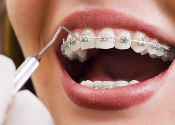 Digital Marketing for Orthodontists
