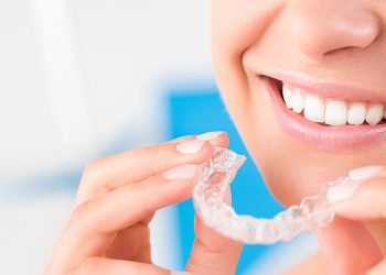 teeth aligners