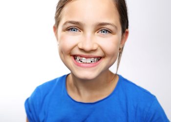 orthodontic intervention