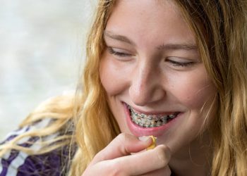 excessive lip support braces